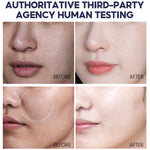 Authoritative_Test_Before_After_Of_Vibrant_Glamour_Niacinamide_Sunscreen