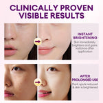 Before_after_comparison_showing_instant_brightening_and_reduced_dark_spots_after_prolonged_use