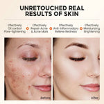 RealBeforeandAfterSkinResults