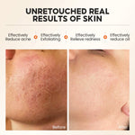 SkinBeforeAfterResults